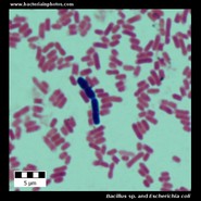 bacillus and escherichia microscopy